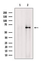 CNKSR3 Antibody in Western Blot (WB)