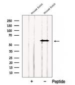 CNKSR3 Antibody in Western Blot (WB)