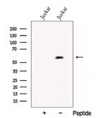 CNOT6 Polyclonal Antibody