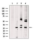 CNOT8 Antibody in Western Blot (WB)
