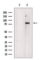 COL23A1 Antibody in Western Blot (WB)