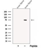 COL23A1 Polyclonal Antibody