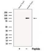 COPG2 Antibody in Western Blot (WB)