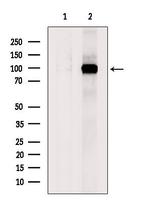 COPG2 Polyclonal Antibody