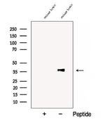 COQ5 Polyclonal Antibody