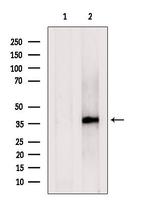 C1GALT1C1 Polyclonal Antibody