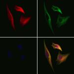 CPNE6 Polyclonal Antibody