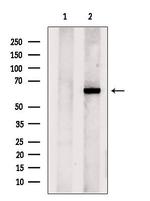 CPNE6 Antibody in Western Blot (WB)