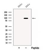 CSDE1 Polyclonal Antibody