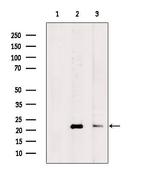 CRP2 Polyclonal Antibody
