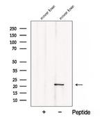 CSRP3 Polyclonal Antibody