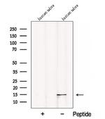 Cystatin 2 Antibody in Western Blot (WB)
