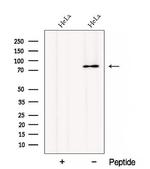 CTAGE1 Polyclonal Antibody