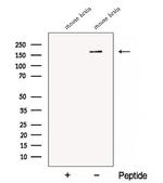 CTTNBP2 Polyclonal Antibody