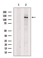 CYFIP2 Antibody in Western Blot (WB)