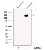 CYFIP2 Antibody in Western Blot (WB)