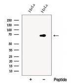 DCP1B Polyclonal Antibody