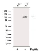 DDX10 Polyclonal Antibody