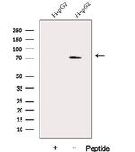 DDX43 Polyclonal Antibody