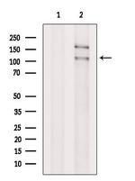 DHX36 Polyclonal Antibody