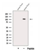 SAPAP3 Antibody in Western Blot (WB)