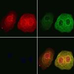 DNAJA2 Polyclonal Antibody