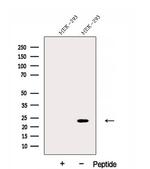 DNAJC12 Polyclonal Antibody