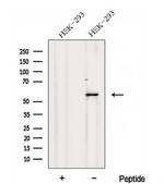 DNPEP Polyclonal Antibody
