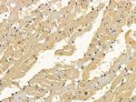 DOCK8 Polyclonal Antibody