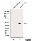 DPEP2 Polyclonal Antibody