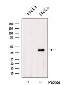 DSN1 Polyclonal Antibody