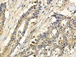 DYNC1LI2 Polyclonal Antibody