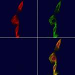 eIF2 gamma Polyclonal Antibody