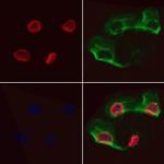 EPCR Polyclonal Antibody
