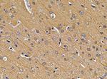 EXOSC10 Polyclonal Antibody