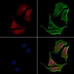 FAM13A Polyclonal Antibody