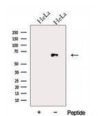 FAM13A Antibody in Western Blot (WB)