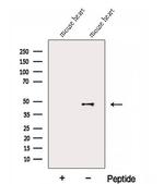 FAM46C Antibody in Western Blot (WB)
