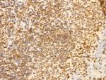 FBXL14 Antibody in Immunohistochemistry (Paraffin) (IHC (P))