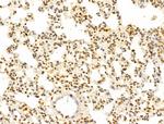 FBXL14 Antibody in Immunohistochemistry (Paraffin) (IHC (P))