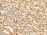 FBXL14 Antibody in Immunohistochemistry (Paraffin) (IHC (P))