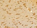 FBXL14 Antibody in Immunohistochemistry (Paraffin) (IHC (P))