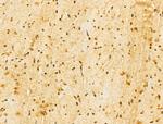 FBXL14 Antibody in Immunohistochemistry (Paraffin) (IHC (P))
