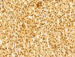 FBXL14 Antibody in Immunohistochemistry (Paraffin) (IHC (P))