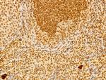 FBXL14 Antibody in Immunohistochemistry (Paraffin) (IHC (P))