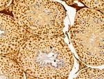 FBXL14 Antibody in Immunohistochemistry (Paraffin) (IHC (P))