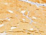 FBG4 Antibody in Immunohistochemistry (Paraffin) (IHC (P))