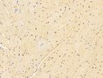 FBXW2 Antibody in Immunohistochemistry (Paraffin) (IHC (P))