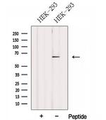 FBXW5 Polyclonal Antibody