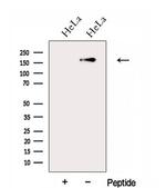 FGD5 Polyclonal Antibody